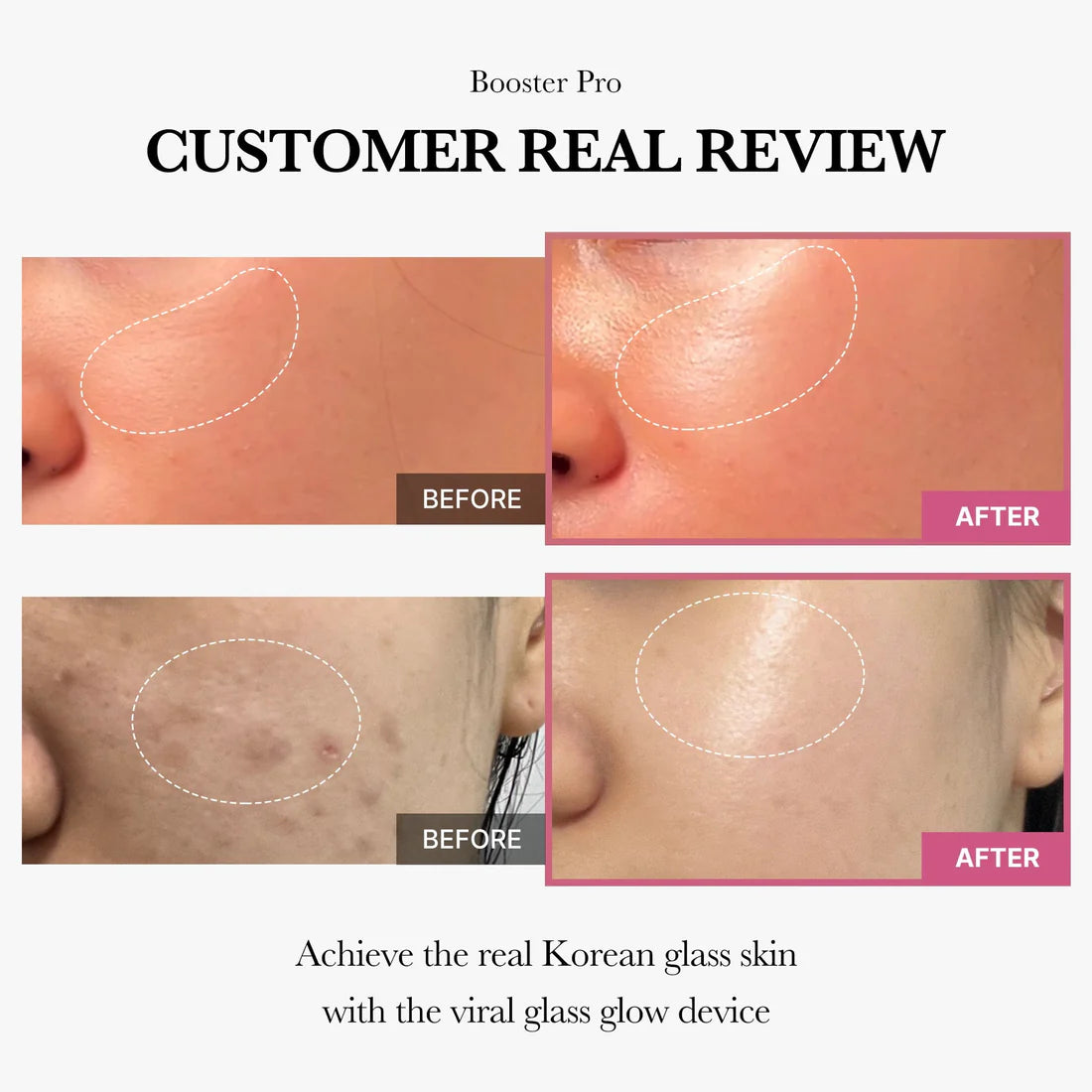 Medicube AGE-R Booster Pro – Korean skincare lifting device, Review