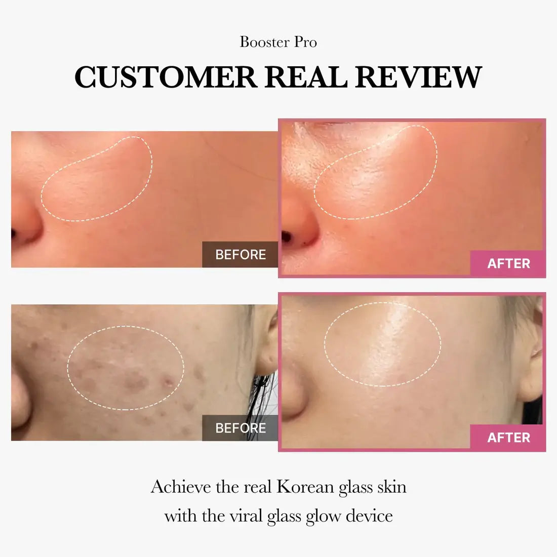Medicube AGE-R Booster Pro (1pc) before anf after usage