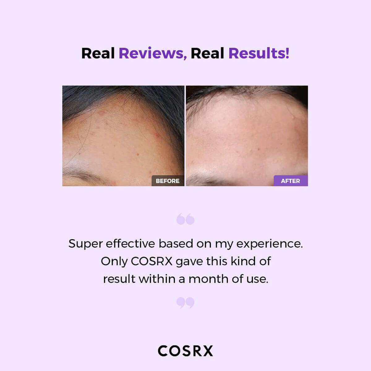 Before and after skin comparison with COSRX branding on a light purple background