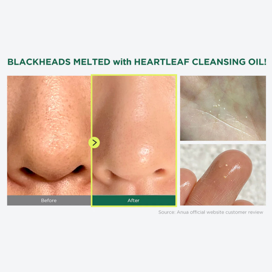 Heartleaf Pore Control Cleansing Oil (200ml)