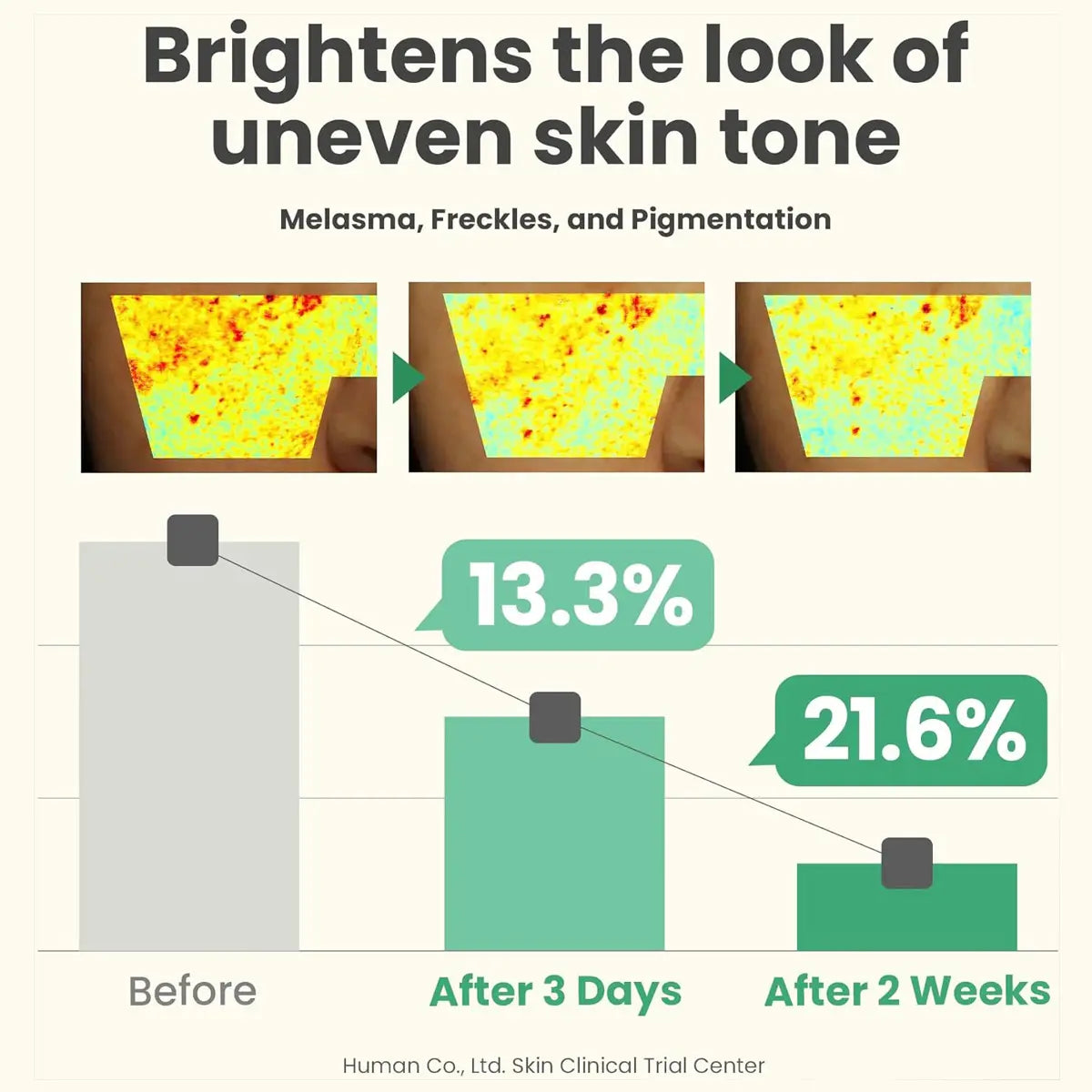 Before and after effects of a skincare product on skin tone, showing a decrease in melanoma, freckles, and pigmentation.