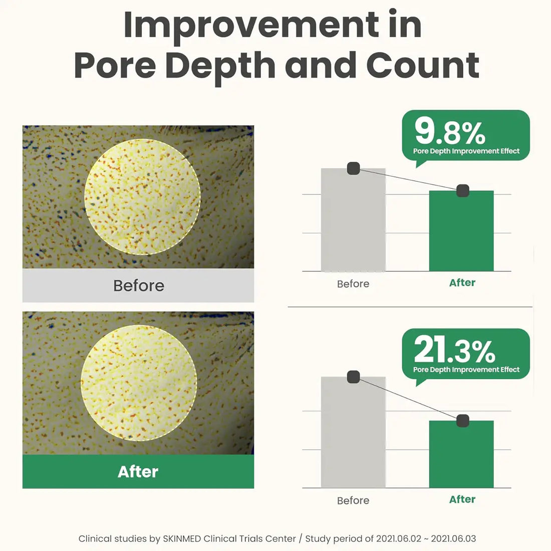 Before and after comparison of pore depth and count with statistical improvement data.