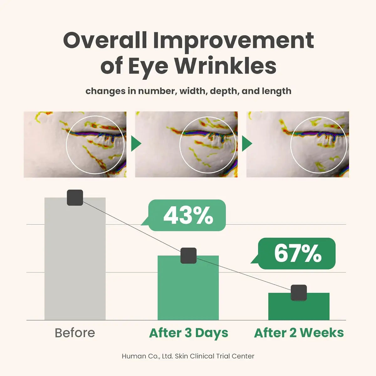 Graph showing improvement of eye wrinkles with percentages before and after 3 days and 2 weeks.