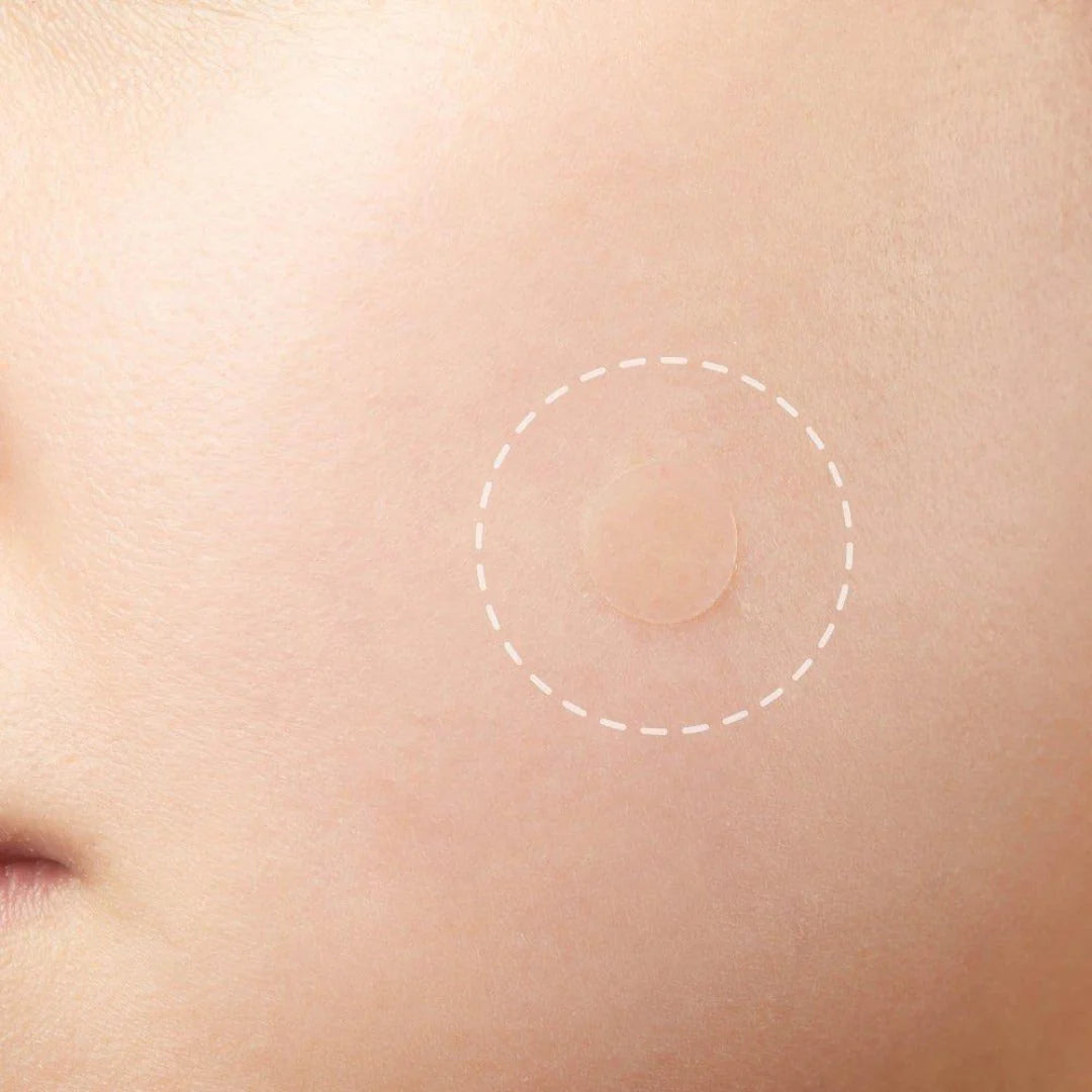 Acne Pimple Master Patch (24pcs)