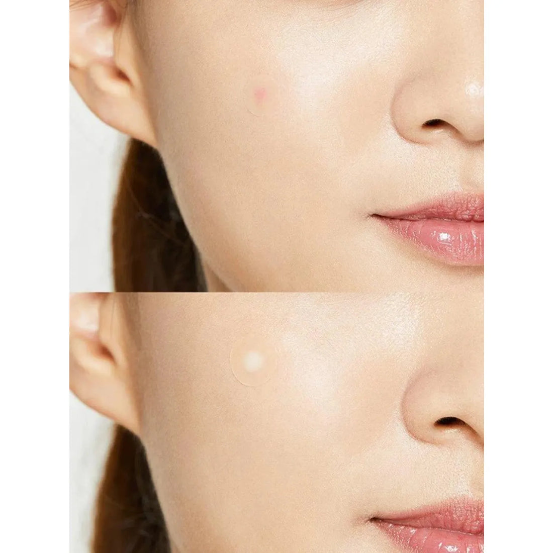 Acne Pimple Master Patch (24pcs)