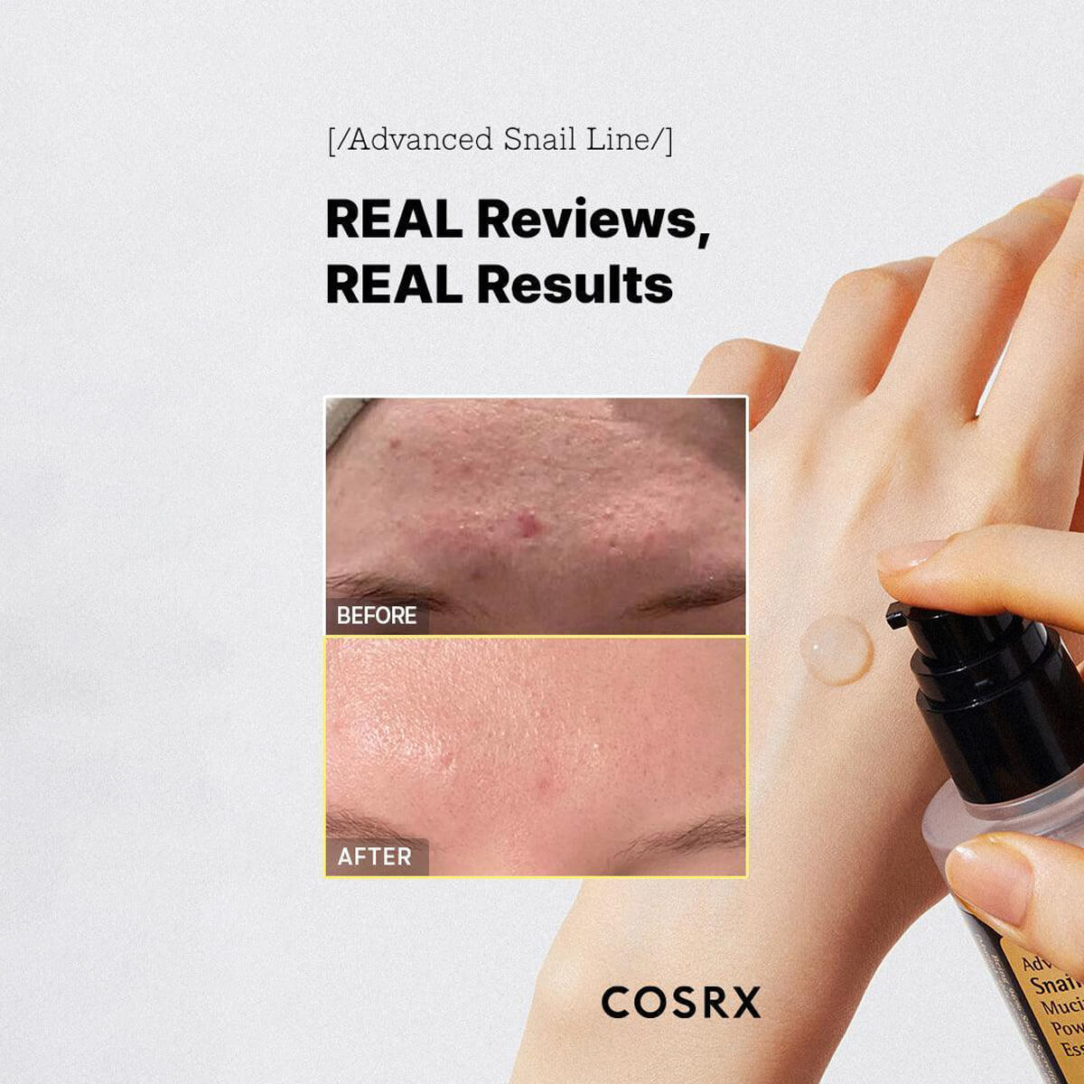 Cosrx skincare product being applied to skin with 'Before' and 'After' results shown.