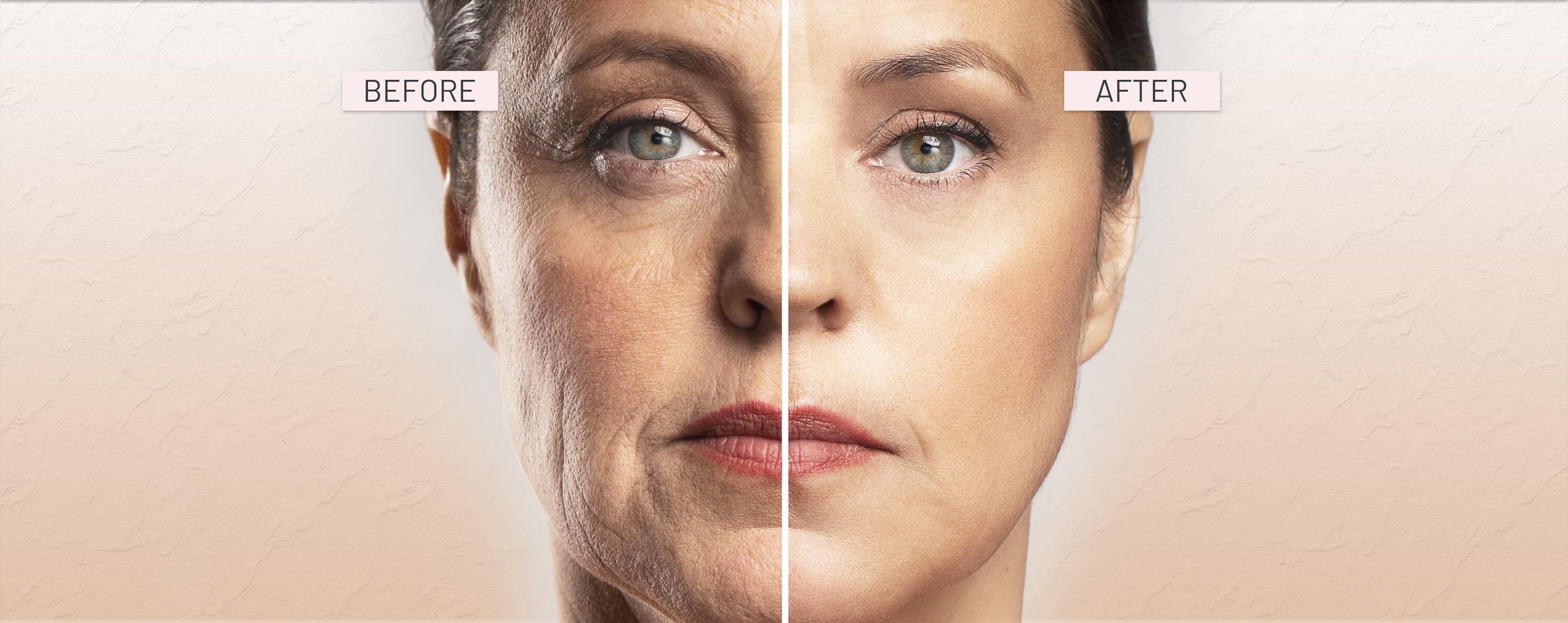 Before and after comparison of a woman's face with visible skin texture differences.