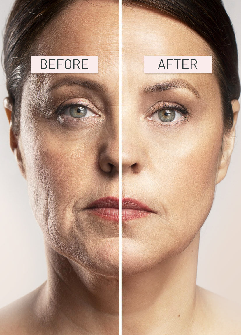 Before and after comparison of a woman's face with visible skin texture differences.