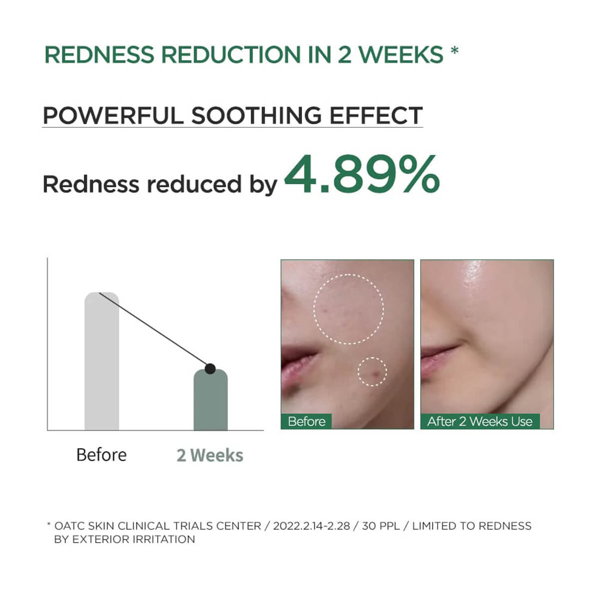 Advertisement showing redness reduction in 2 weeks with a before and after comparison of skin.
