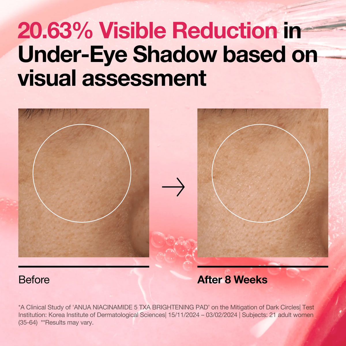 Before and after comparison of under-eye shadow reduction with text on a pink background