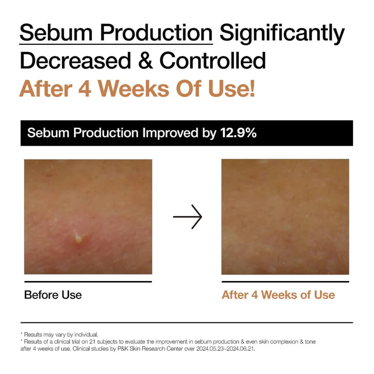Before and after comparison of sebum production improvement on skin with text indicating a 12.9% improvement after 4 weeks of use.