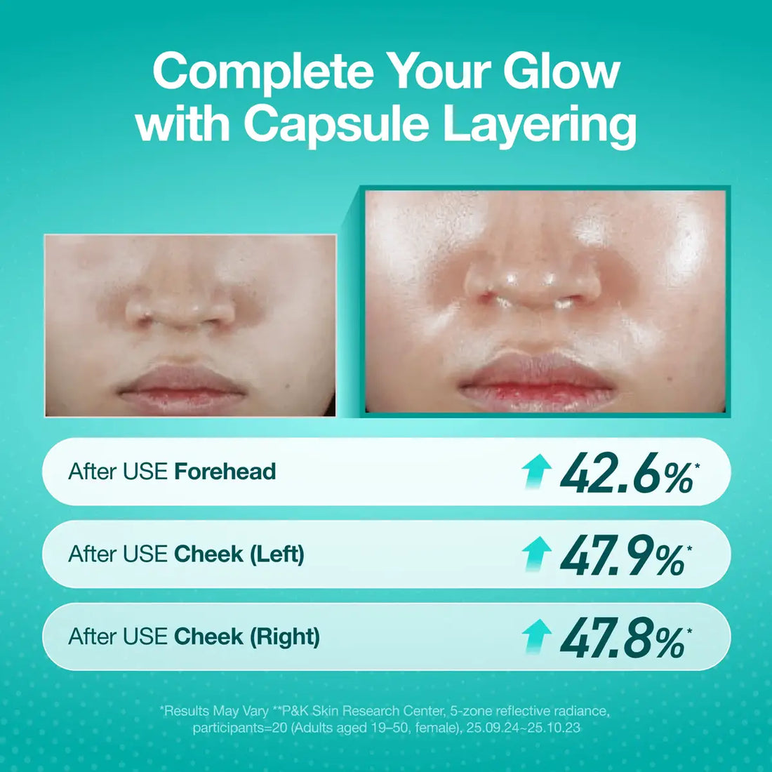 Before and after comparison of capsule layering on a person's face with percentage increase on forehead and cheeks.