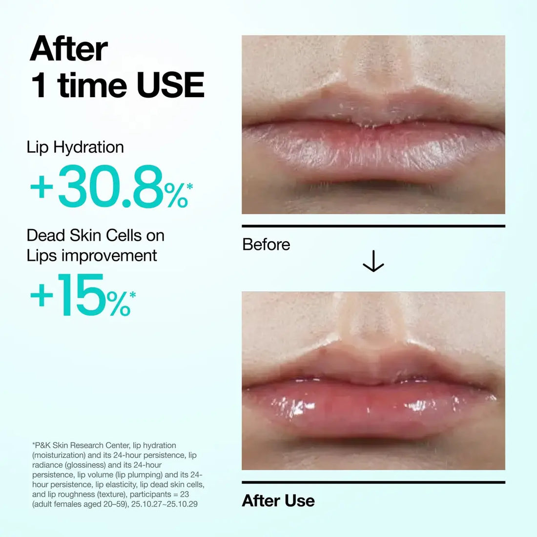 Anua PDRN Hyaluron Lip Serum 10ml