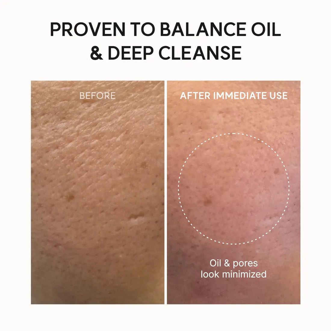 Before and after skin comparison showing oil and pore minimization with text 'Proven to balance oil & deep cleanse'.