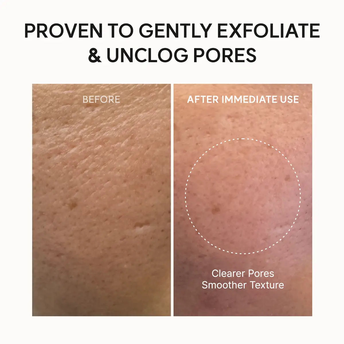 Before and after skin texture comparison with text indicating product's effectiveness.