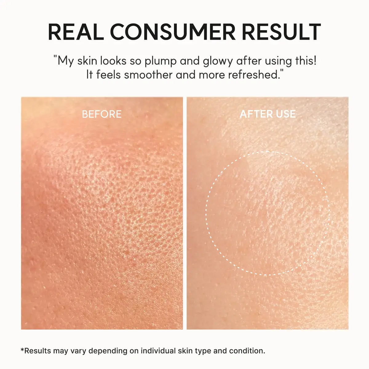 Before and after skin texture comparison with text indicating consumer result.