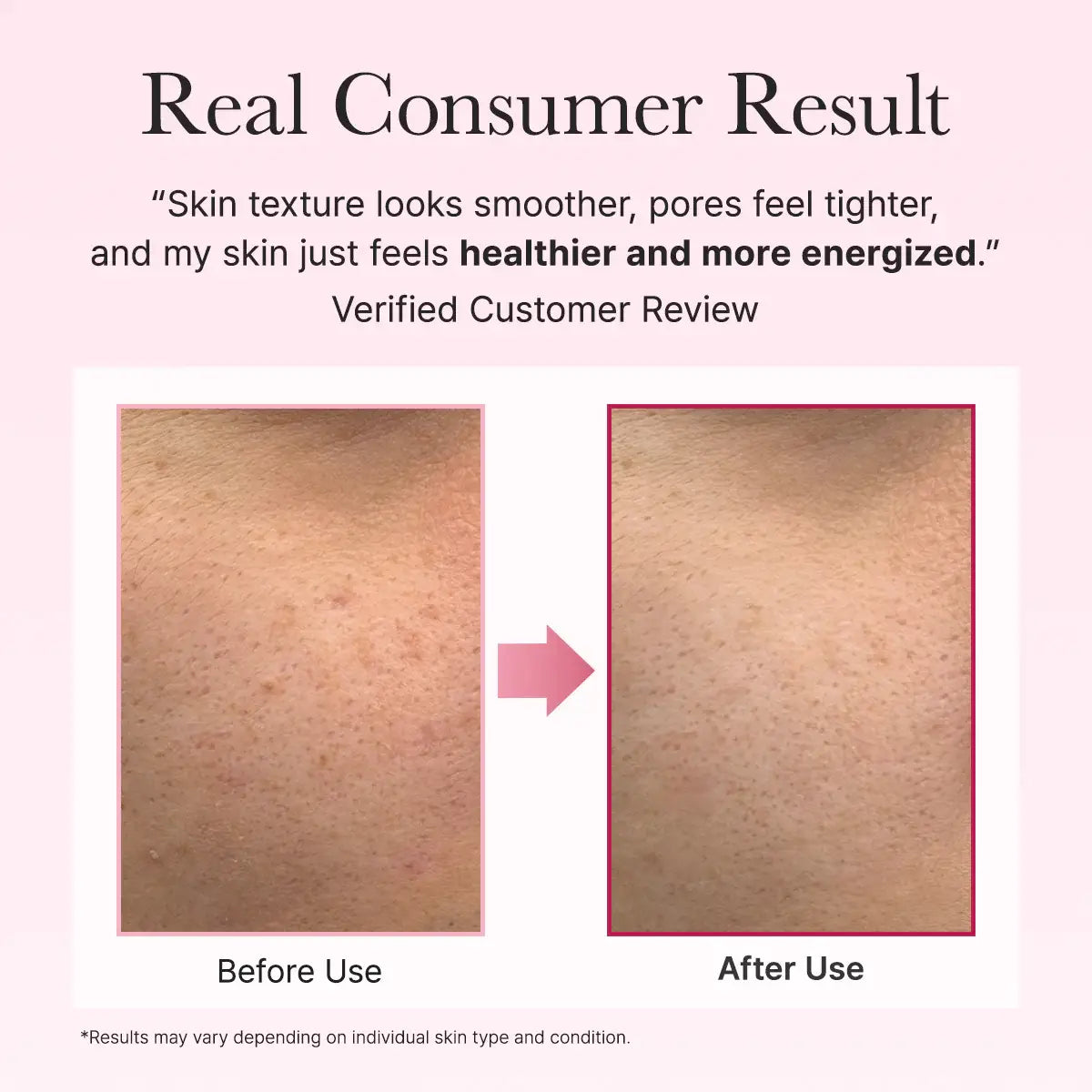 Before and after skin texture comparison with customer review text on a pink background