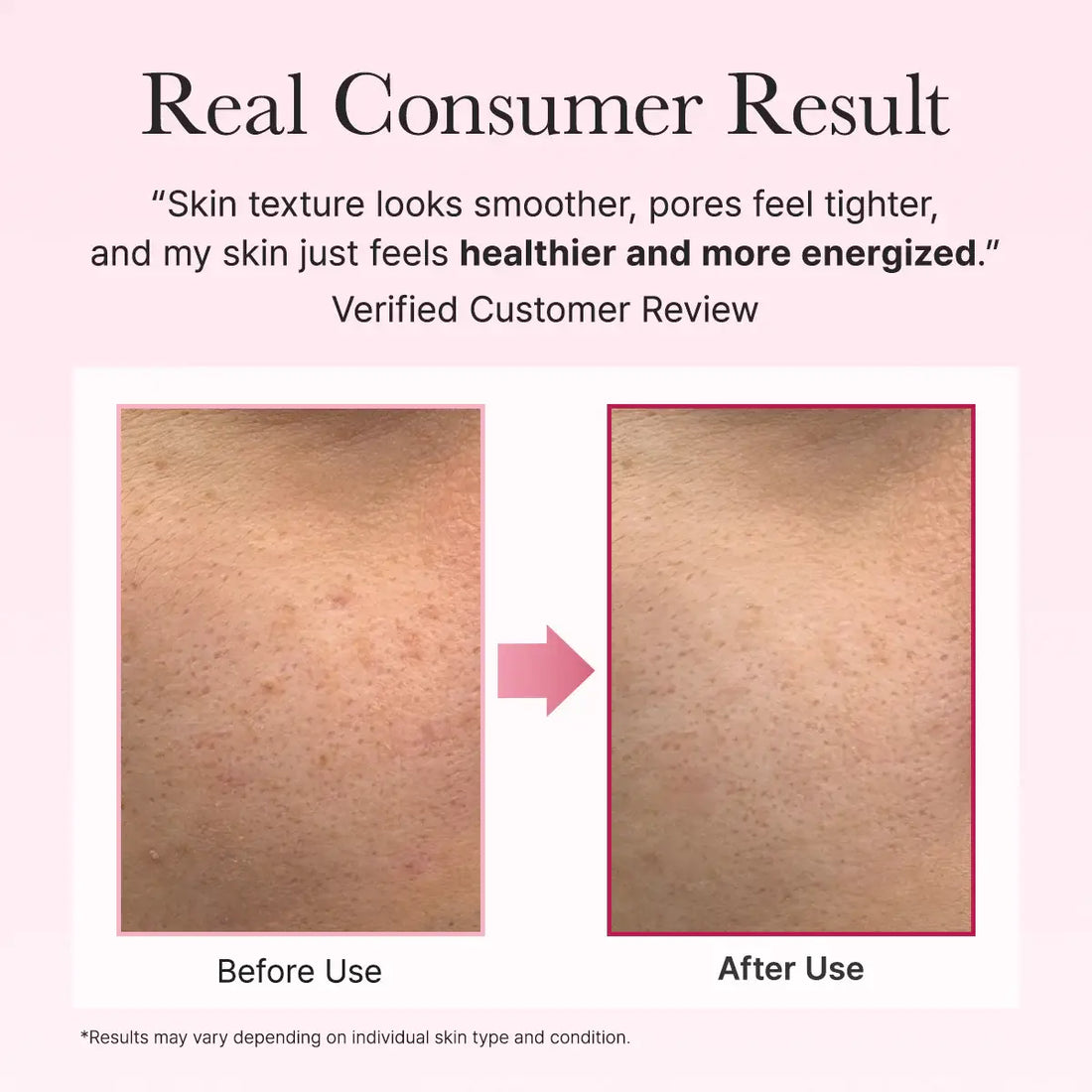 Before and after skin texture comparison with customer review text on a pink background