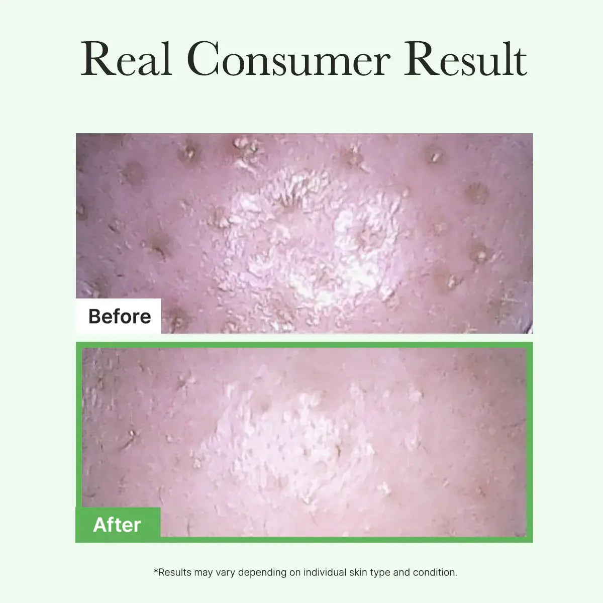 Before & After rusults.