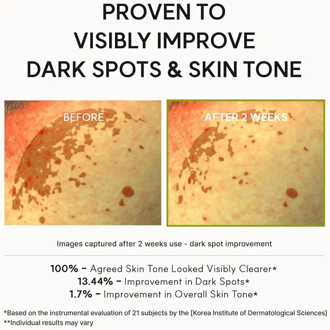 Before & after using Arencia Vitamin C Booster Shot Serum 30ml