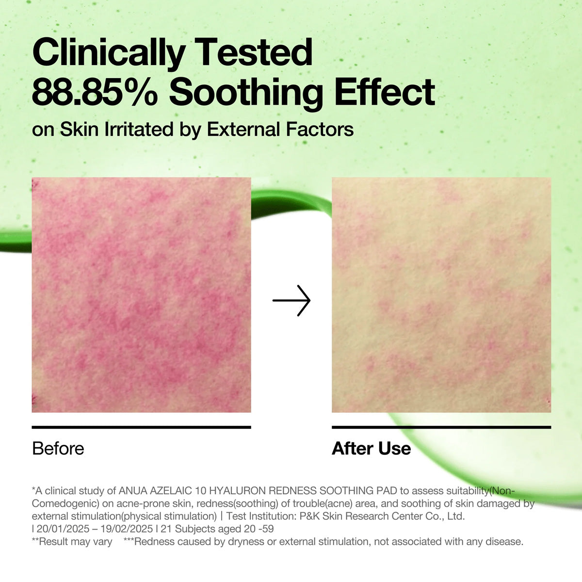 Before and after effect of a skincare product on skin irritation with clinical testing results.