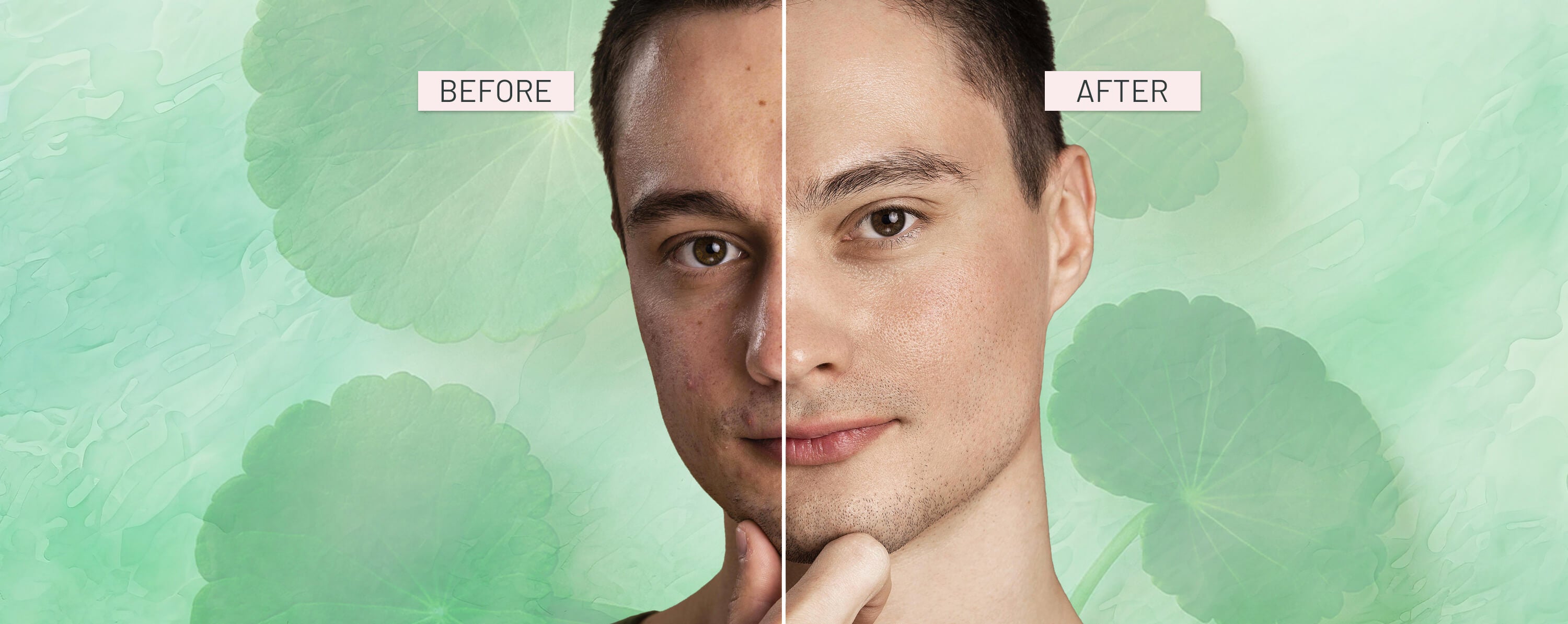 Before and after comparison of a person's face on a green floral background - Barrier repair
