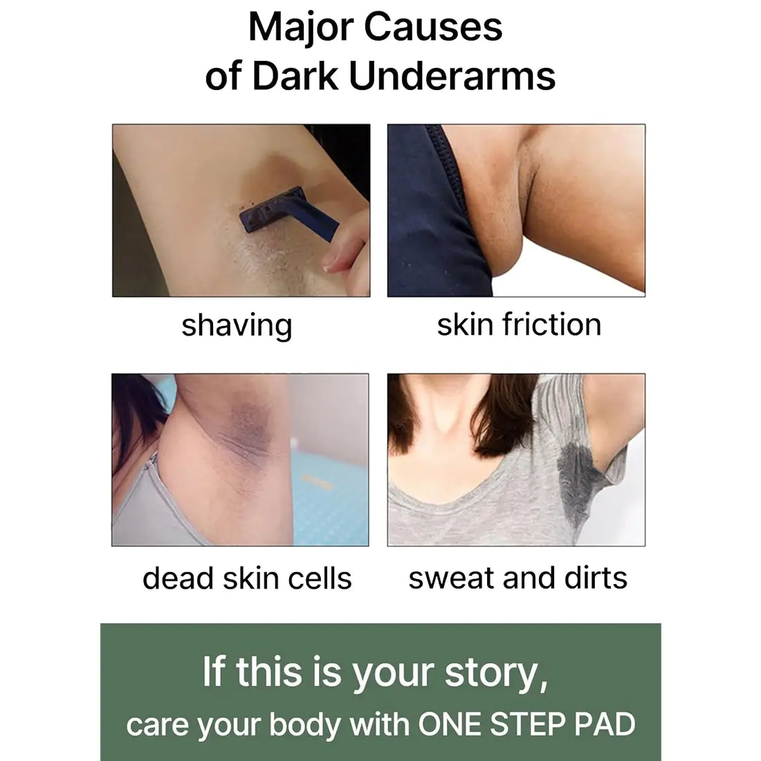 Diagram showing major causes of dark underarms with images and text.