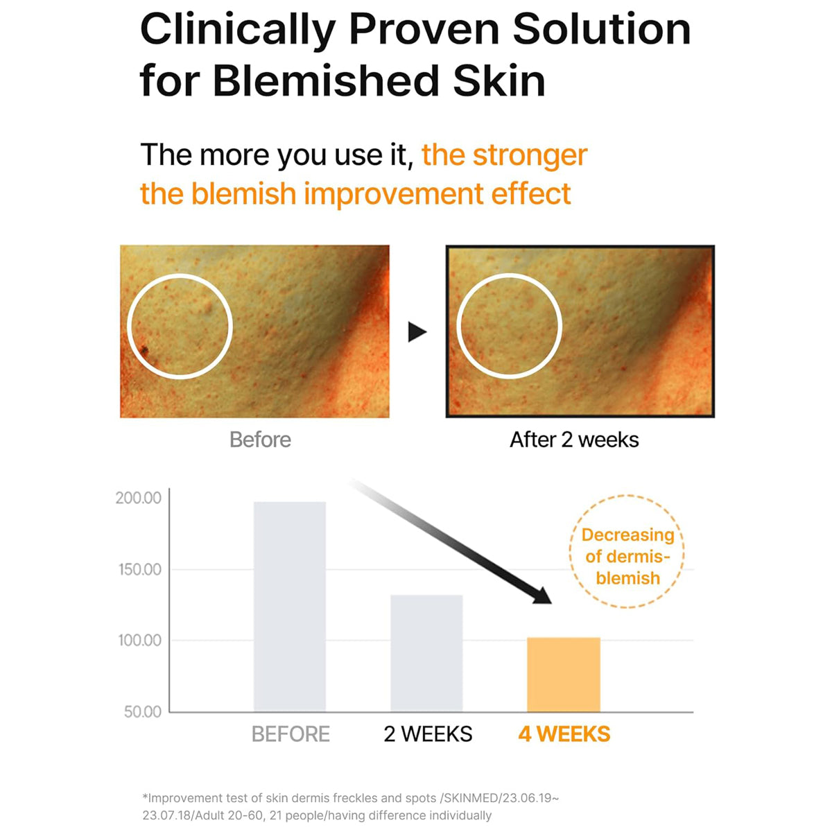 Celimax Pore+Dark Spot Brightening Serum – Korean skincare serum for pigmentation, pores, and dull skin. Before & After