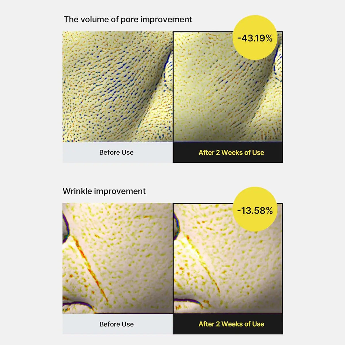 Before and after effects of a skincare product on skin texture and wrinkles.