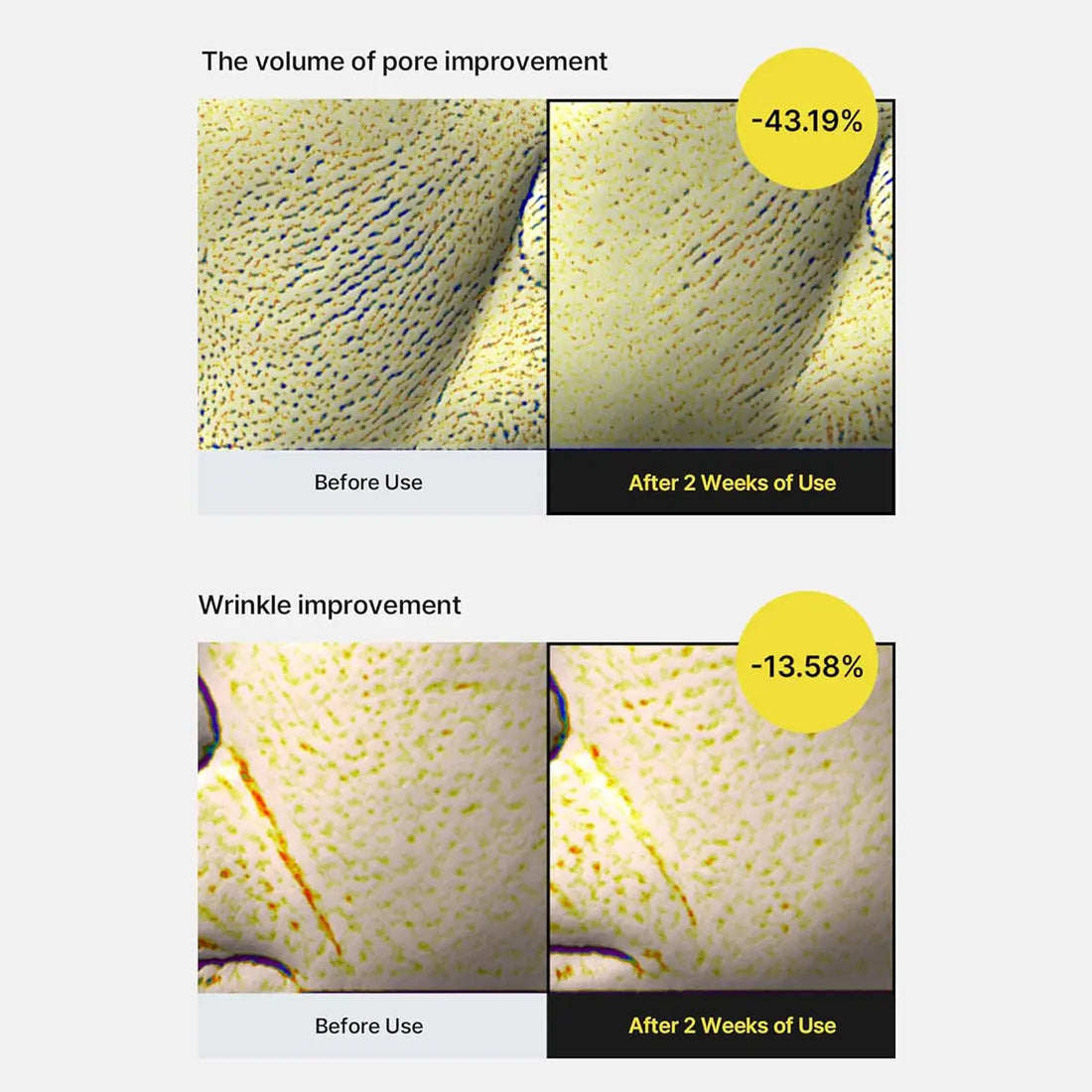Before and after effects of a skincare product on skin texture and wrinkles.