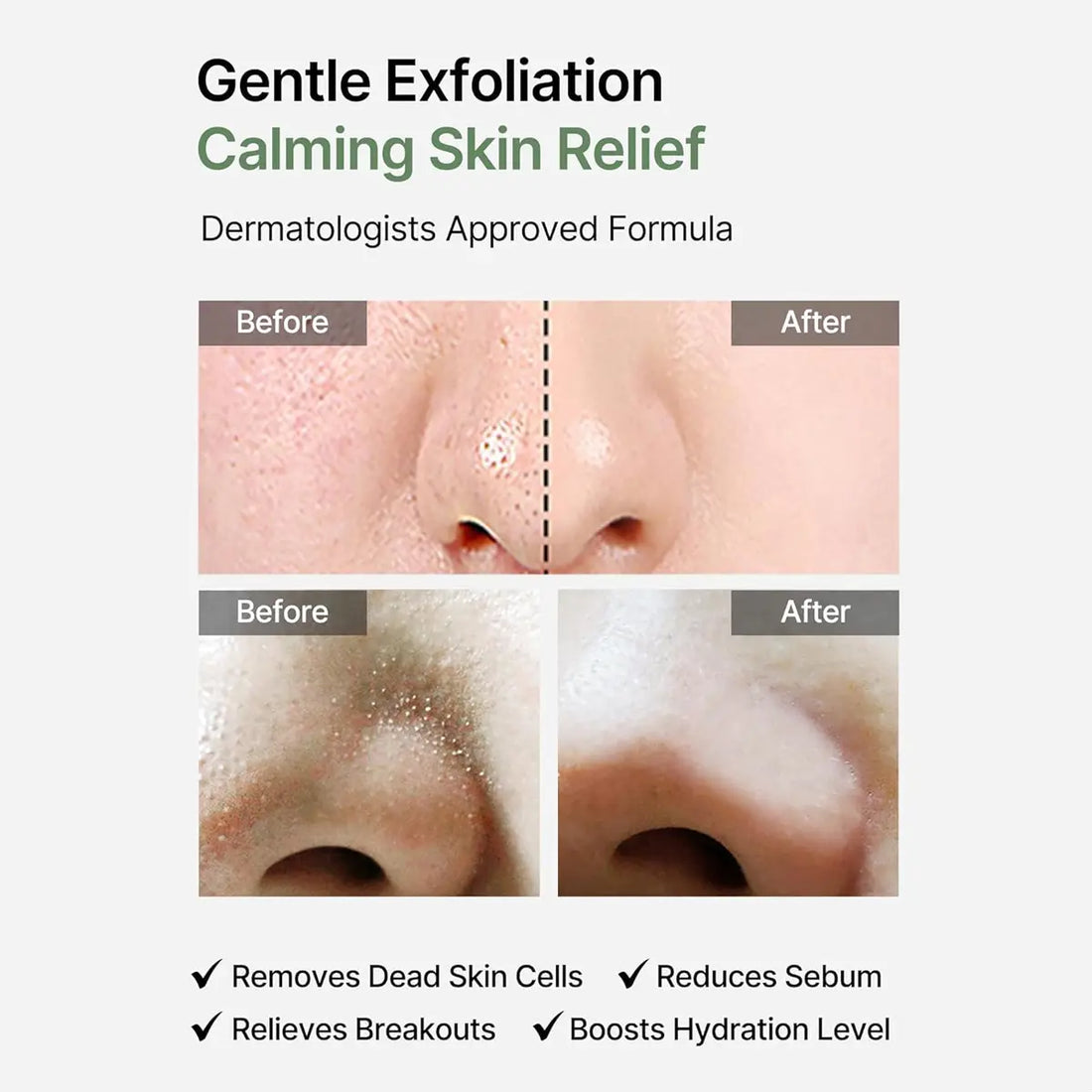 Before and after effects of a gentle exfoliation product on skin, with text indicating dermatologists' approval.