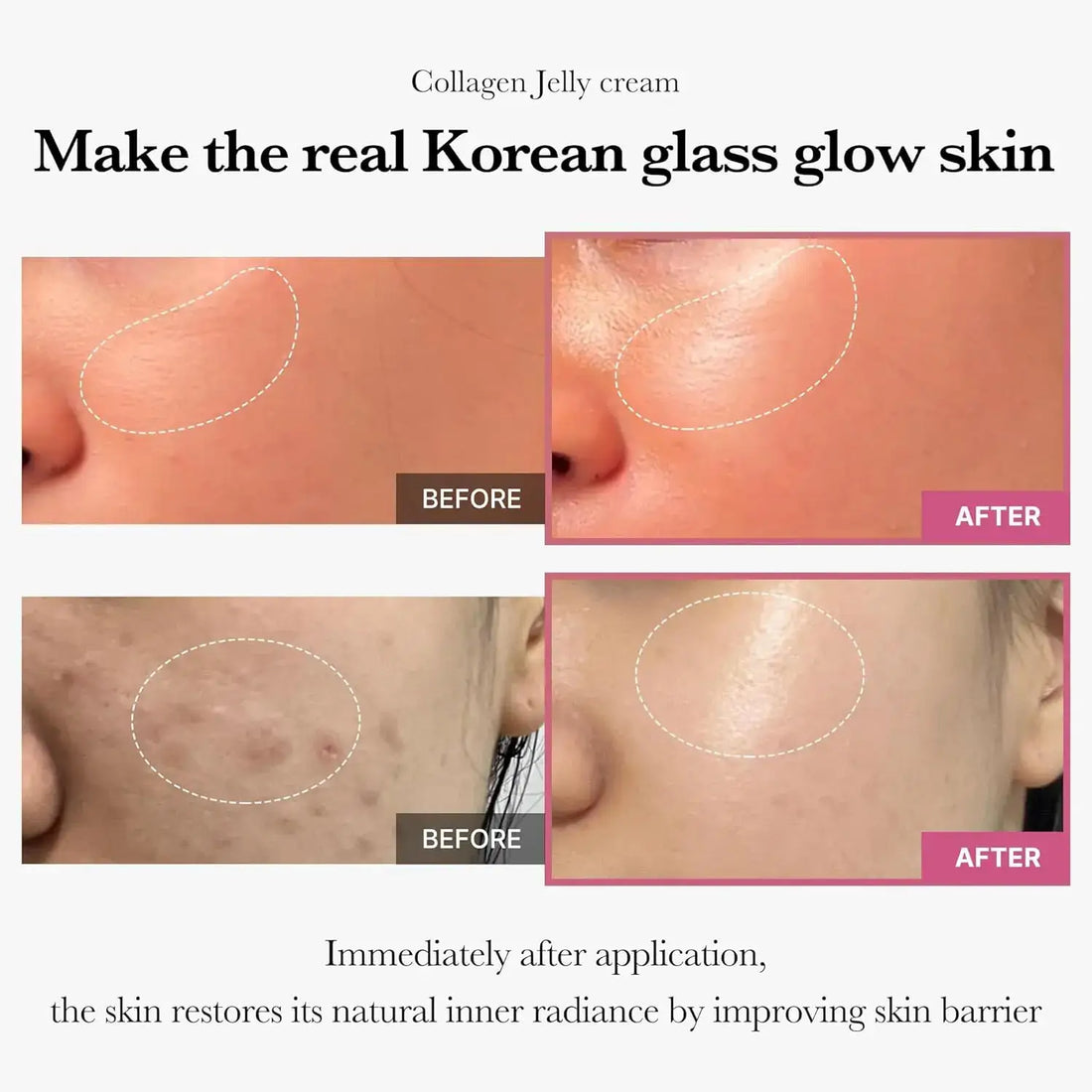 Before and after images demonstrating the effectiveness of Medicube Collagen Jelly Cream for achieving glowing skin.