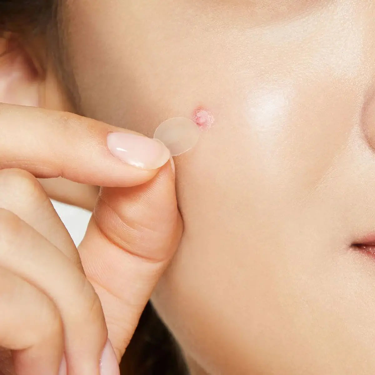 Person applying a small Cosrx pimple patch to their skin