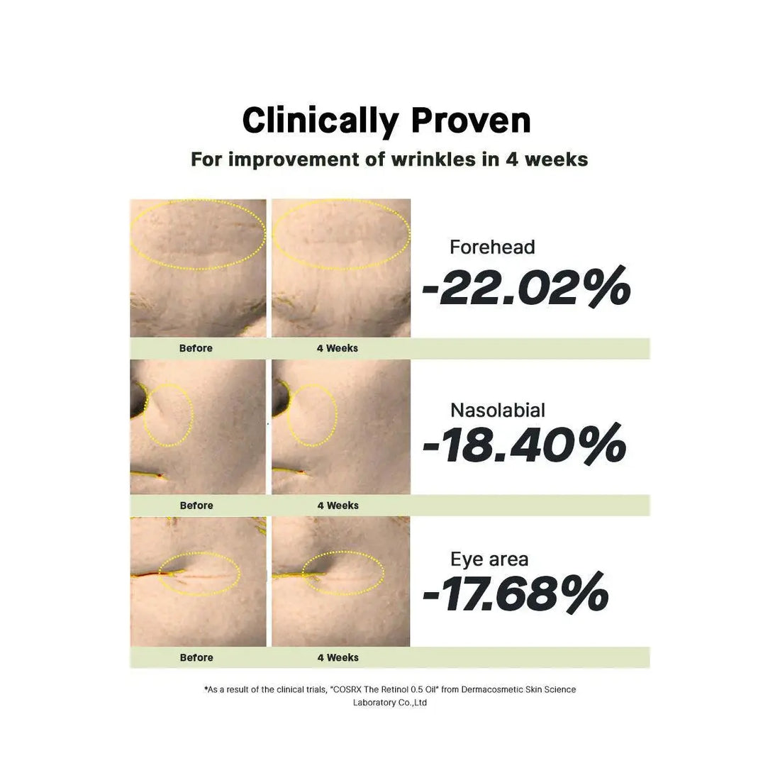 Before and after skin treatment results showing wrinkle reduction on forehead, nasolabial, and eye area with percentages.