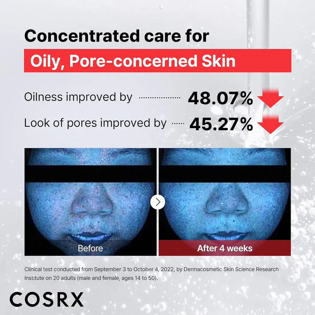 Cosrx skincare product advertisement showing before and after effects on oily, pore-concerned skin.
