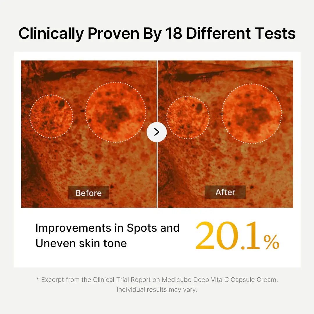 Before and after comparison of skin with improvements in spots and uneven skin tone, clinically proven by 18 tests.