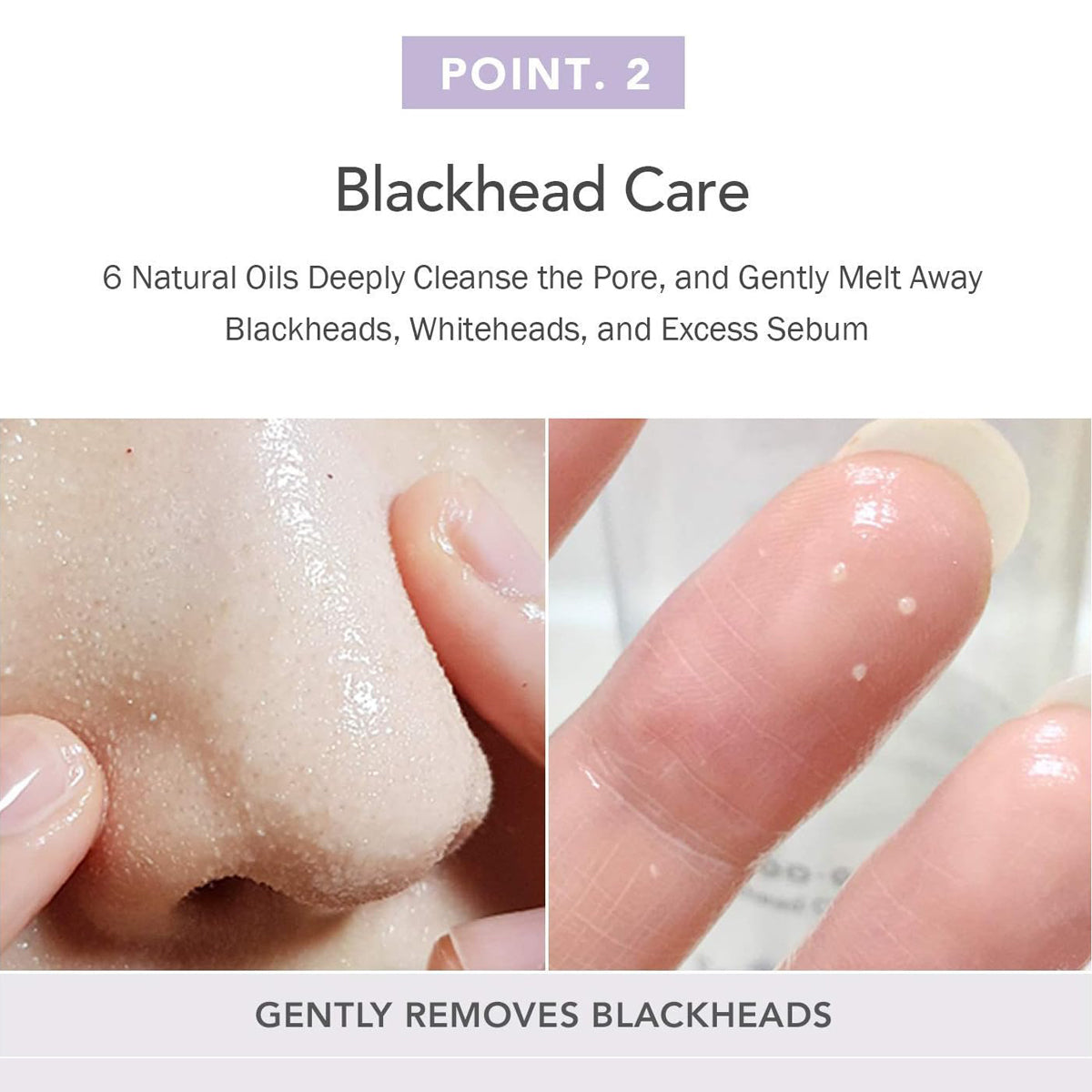 Product for blackhead care with close-up of nose and blackheads being removed.