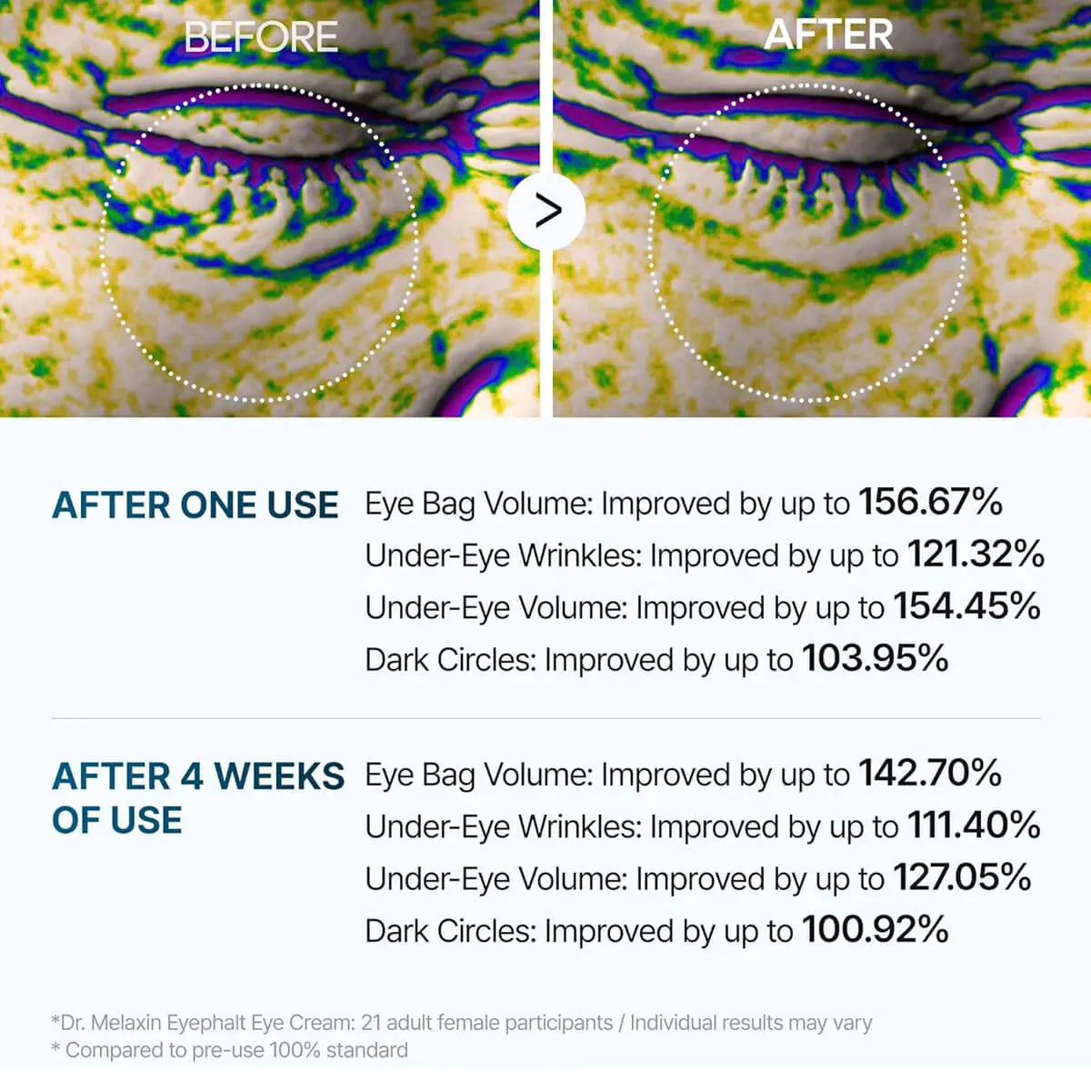 Before and after comparison of eye cream effects on eye bags, wrinkles, volume, and dark circles with text detailing improvement percentages.