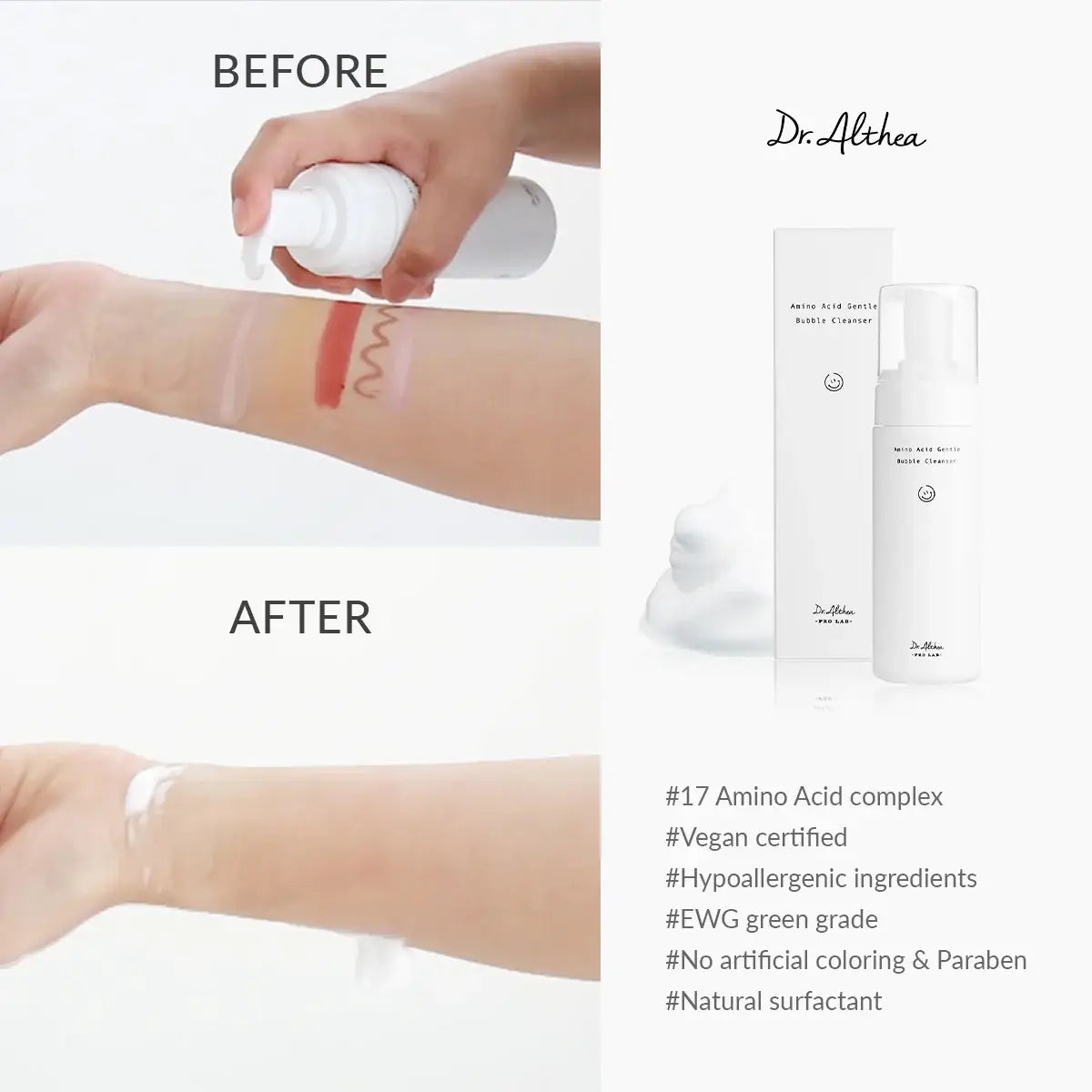 Before and after comparison of a skin treatment with Dr. Althea products on a white background.