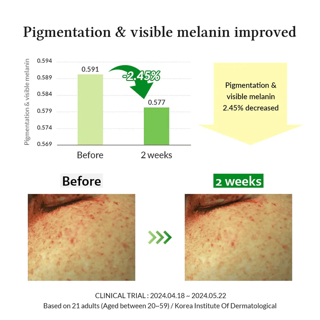 Graph and before-and-after images showing improvement in pigmentation and visible melanin.