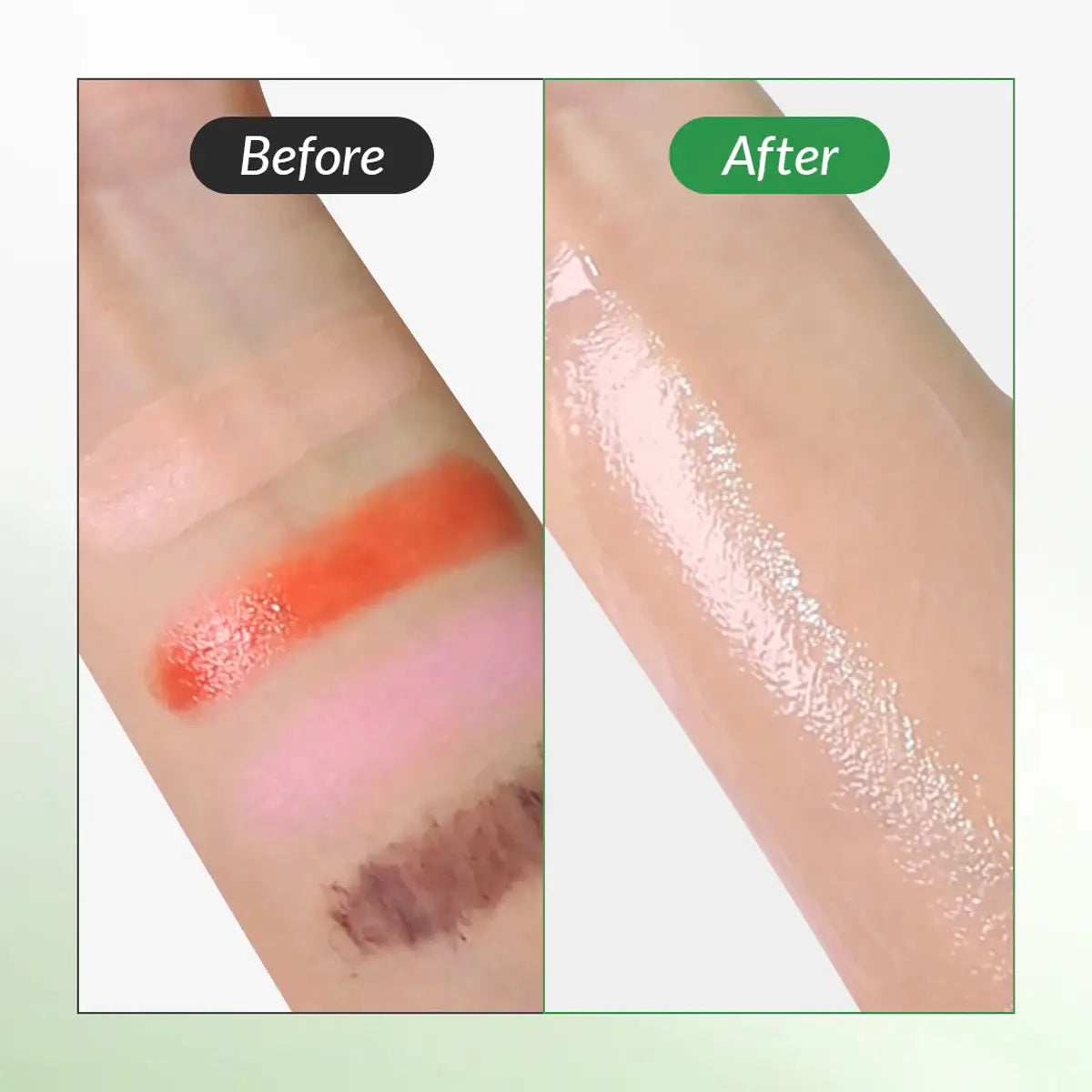 Before and after comparison of a skin treatment on a person's arm.