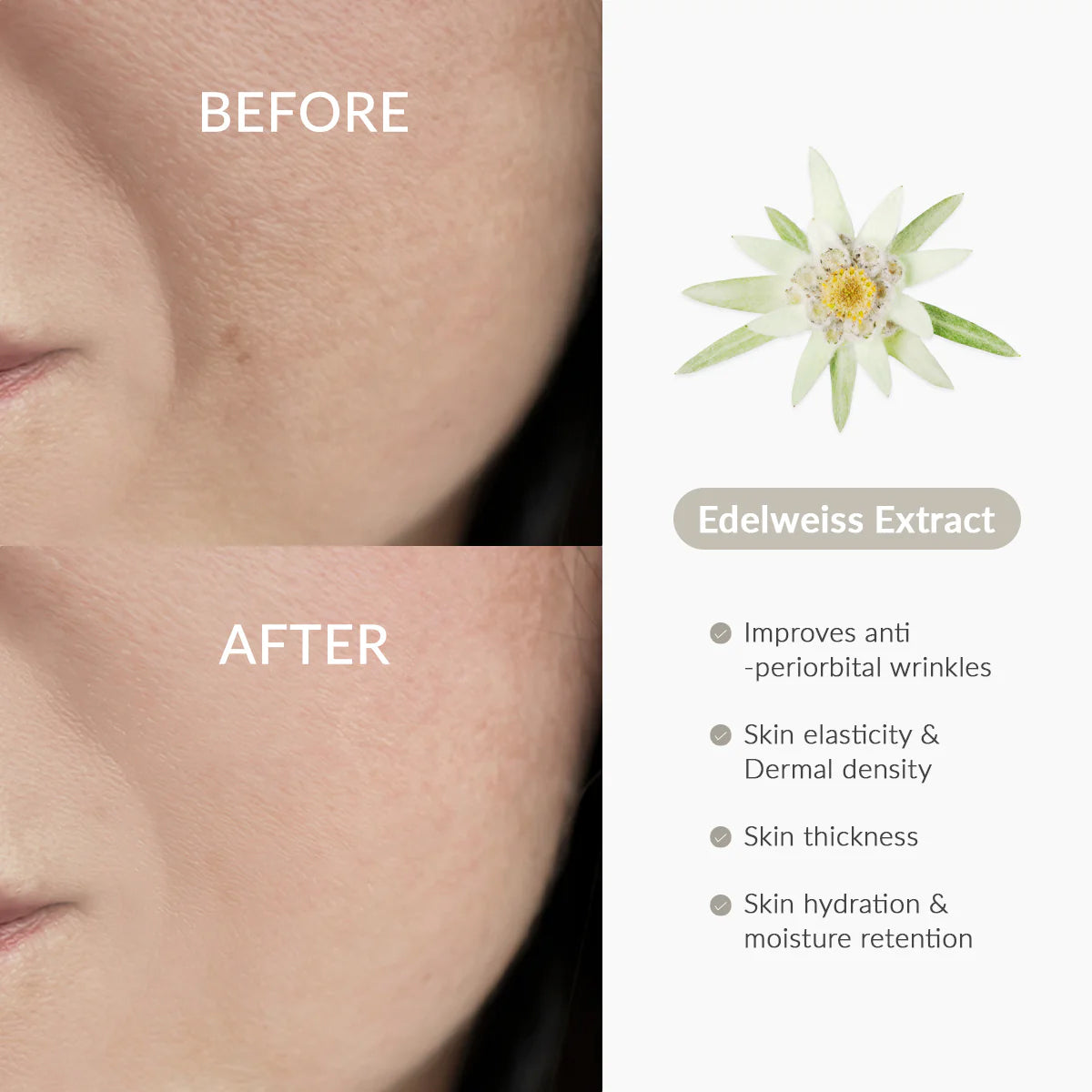 Dr. Althea Rapid Firm Sculpting Cream – Korean Skincare moisturizer for anti-aging, firming, and skin elasticity improvement. Before & After