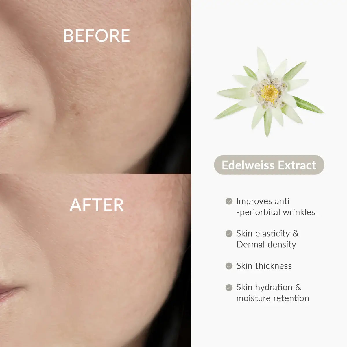 Before and after comparison of skin with Edelweiss Extract benefits on a white background.