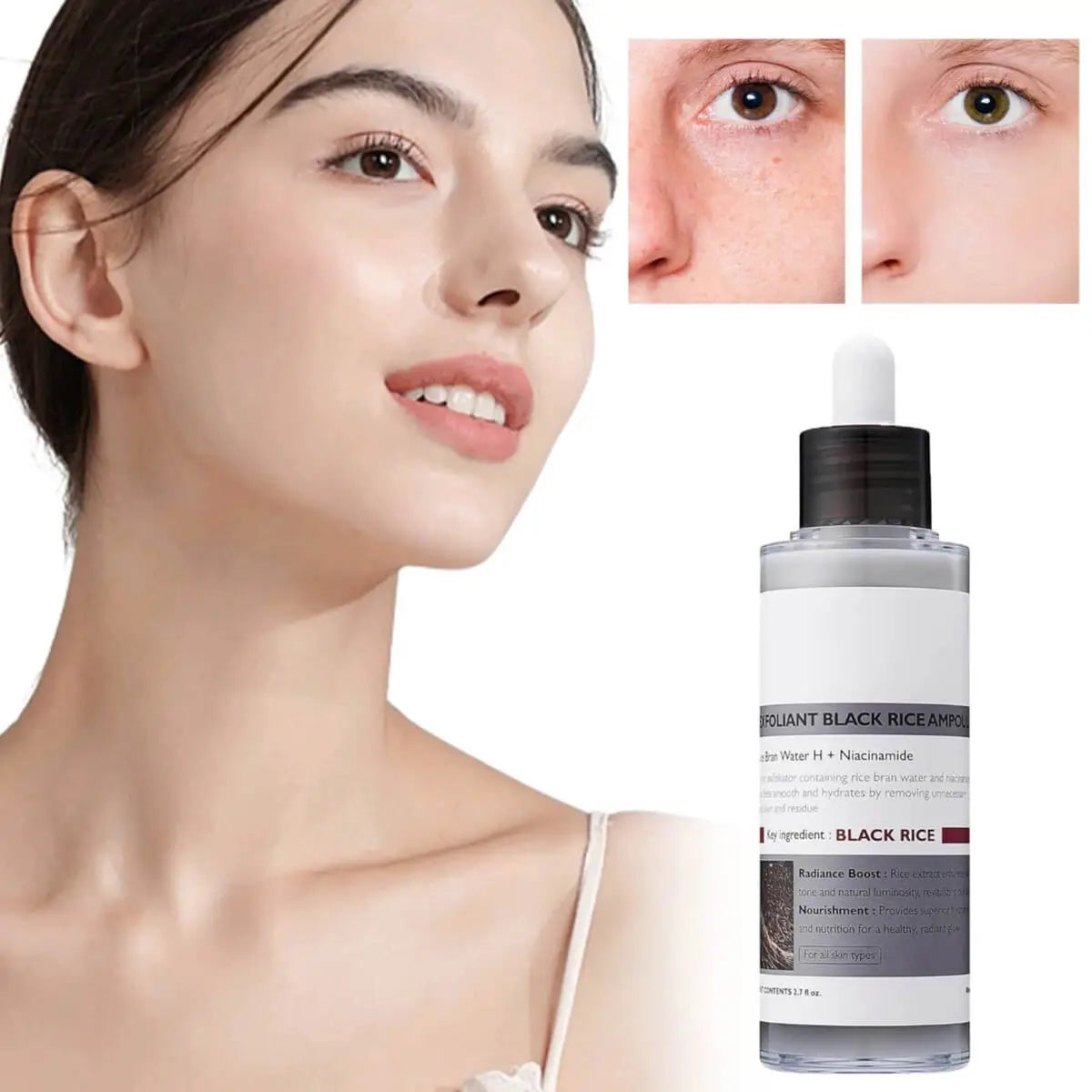 Woman with clear skin next to a bottle of skincare product, showing before and after effects.
