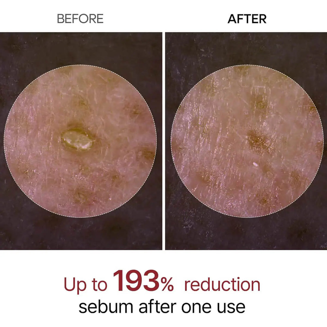 Before and after comparison of sebum reduction on skin with text indicating 193% reduction.
