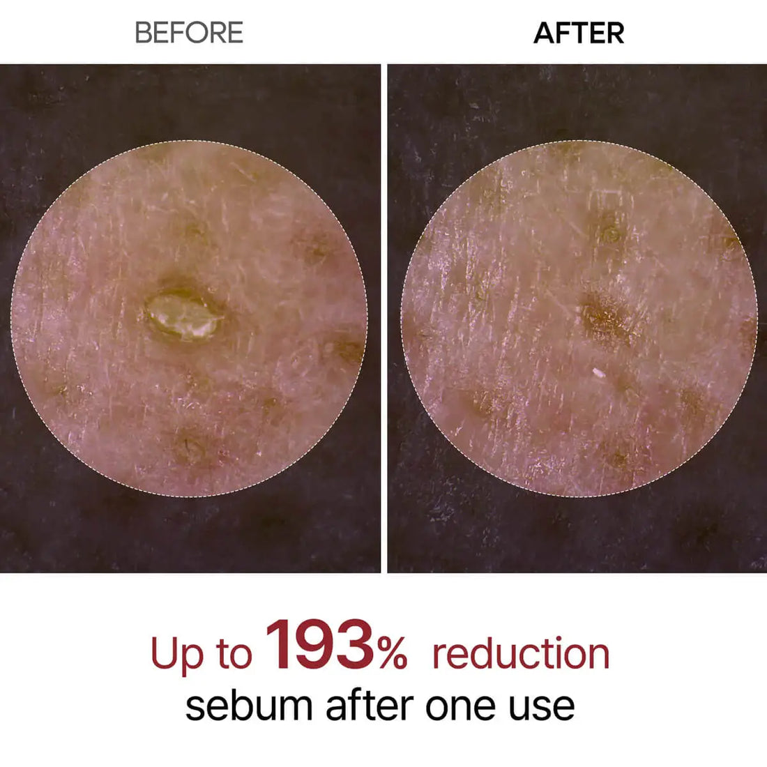 Before and after comparison of sebum reduction on skin with text indicating 193% reduction.