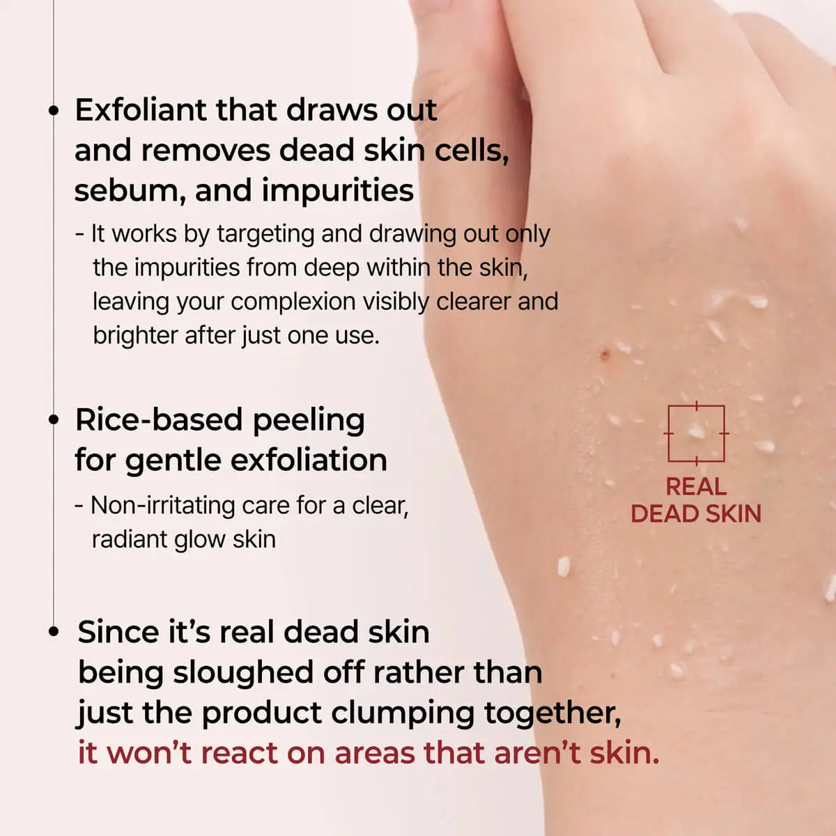Hand with visible dead skin cells and exfoliant text on a white background