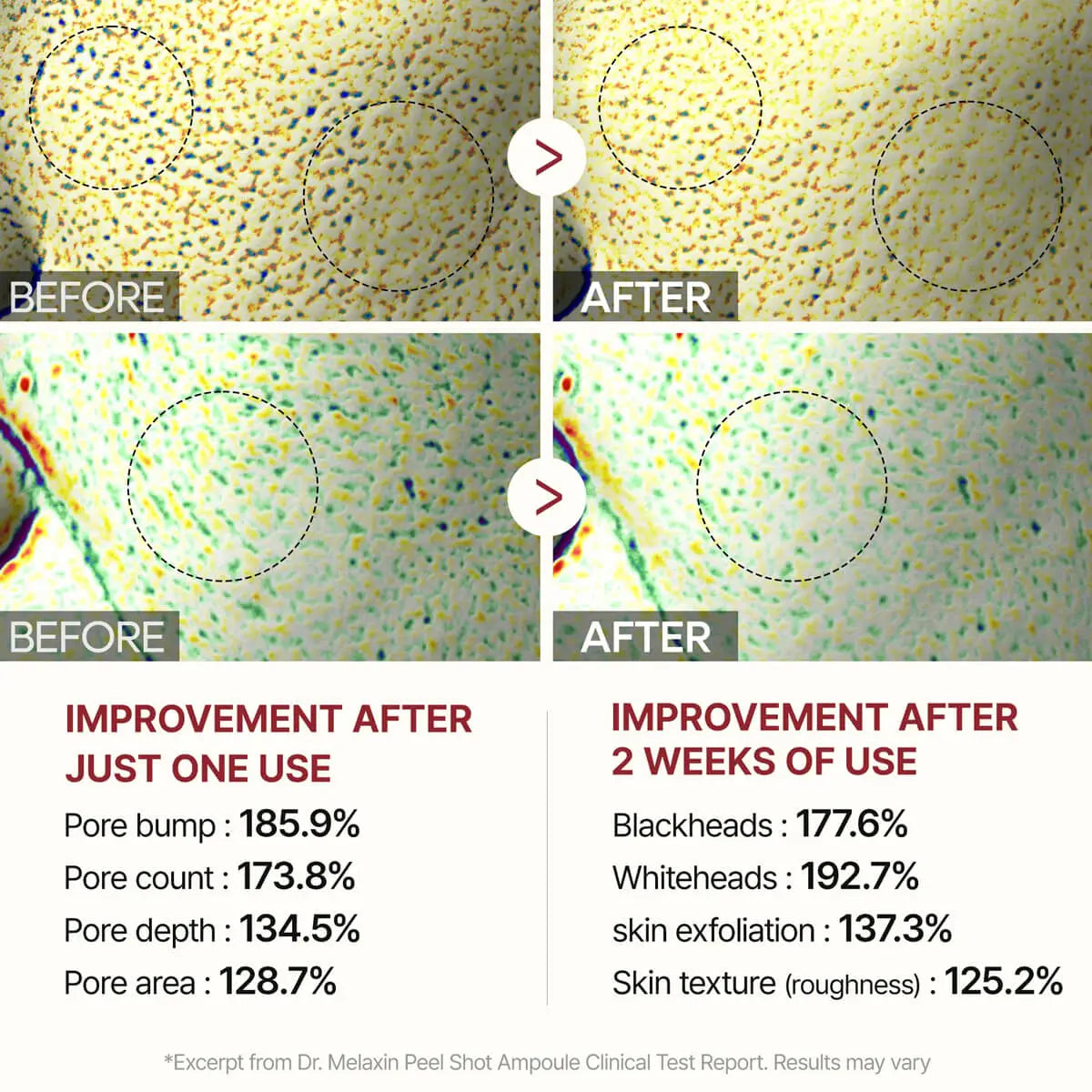 Before and after comparison of skin treatment with improvement statistics.