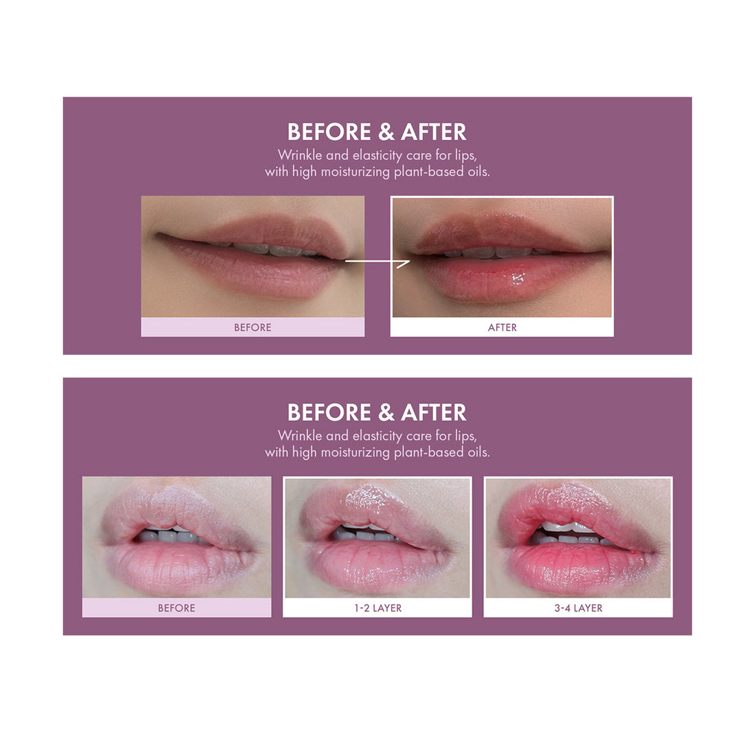 Before and after comparison of lip care treatment with a purple background