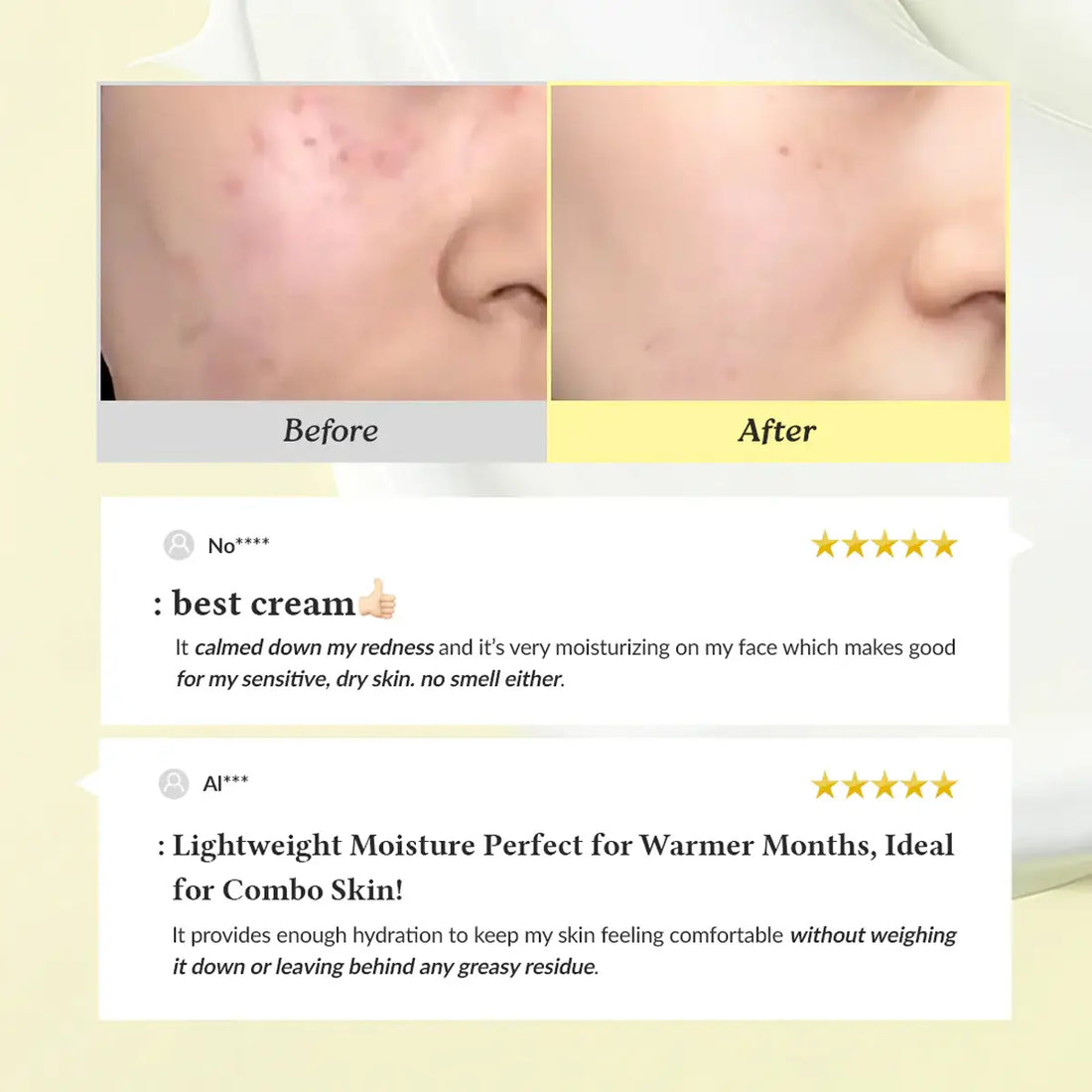 Before and after comparison of skin with a cream application, featuring user reviews.